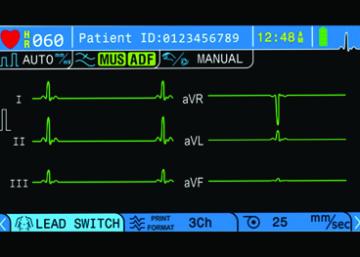 BPL Cardiart 3-channel ECG Machine GenX3