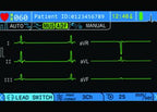 BPL Cardiart 3-channel ECG Machine GenX3