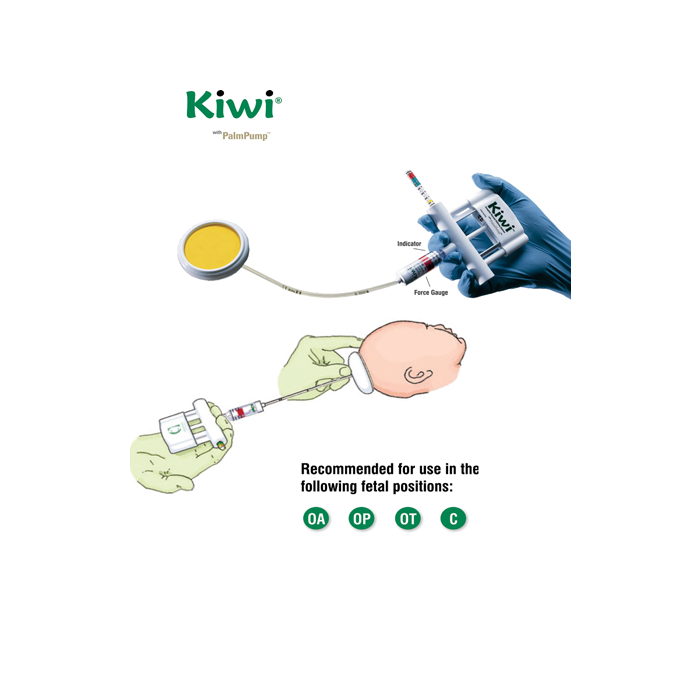 Kiwi Omni Cup Vacuum Delivery Pump